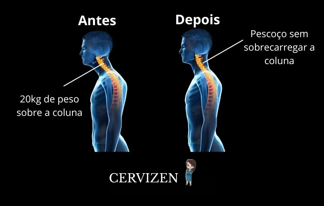 Antes e depois CerviZen
